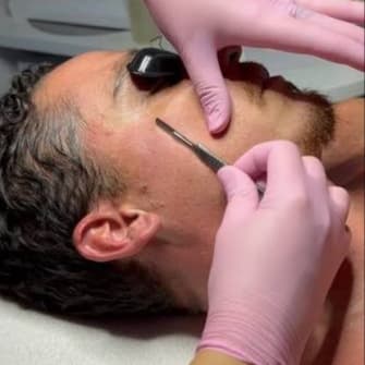 The Sharp Edge · 6-Pack at The UnSpa | Skin Renewal Studio in Chandler, AZ