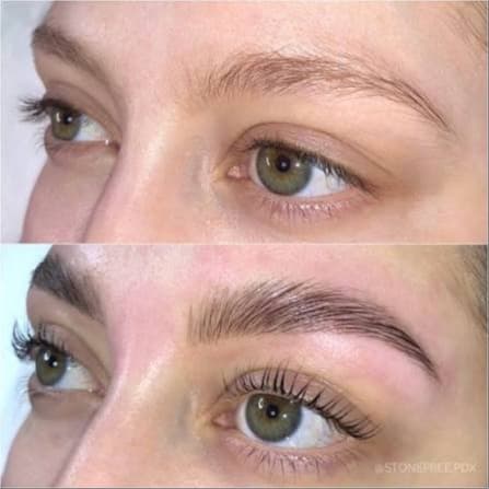 Lift+Transform · 6-Pack at The UnSpa | Skin Renewal Studio in Chandler, AZ